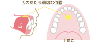 すぽット