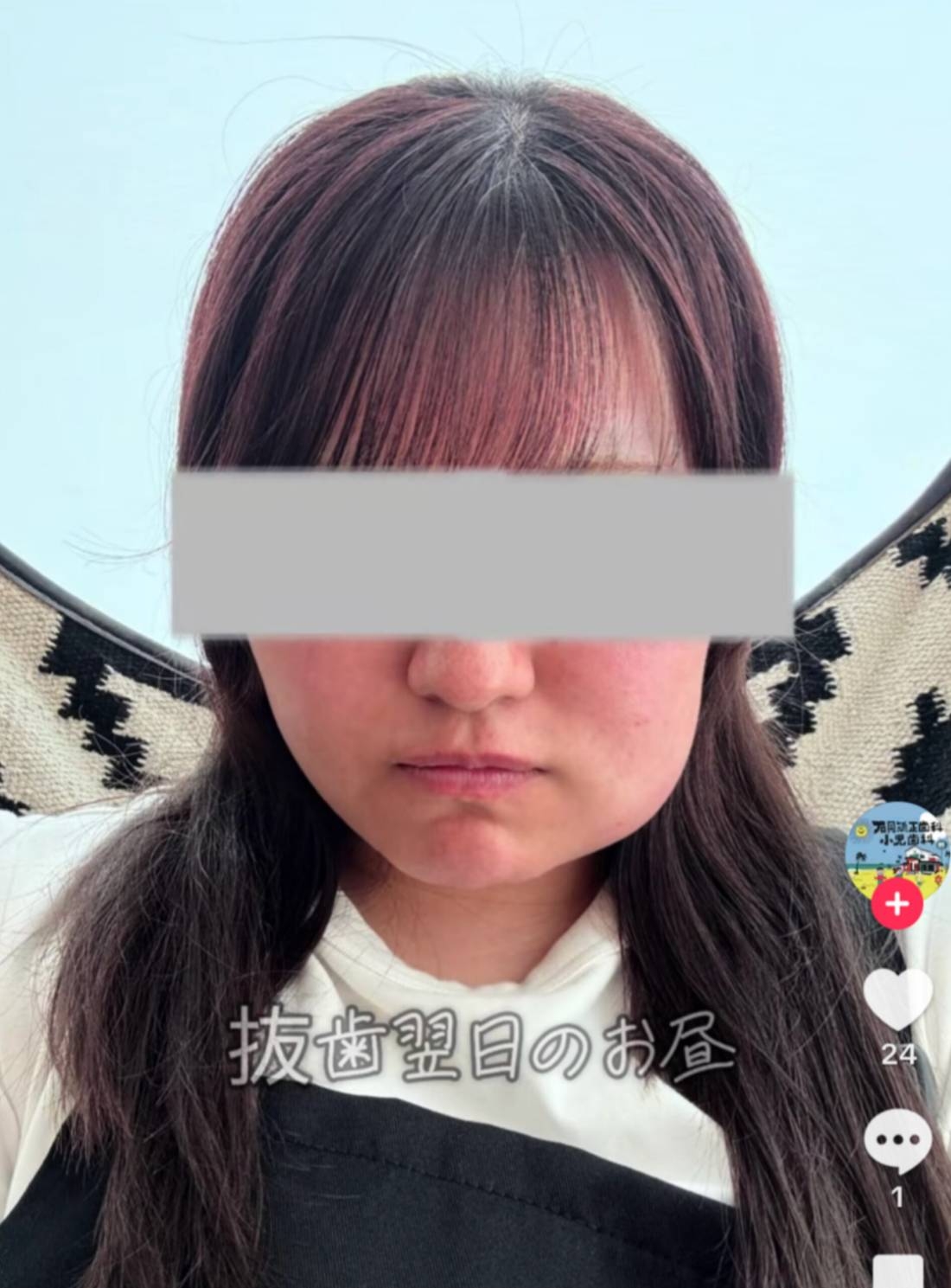 顔が腫れたはなチャン