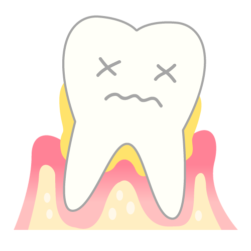 歯周病１